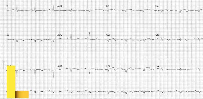 Low picnic table rentals near me